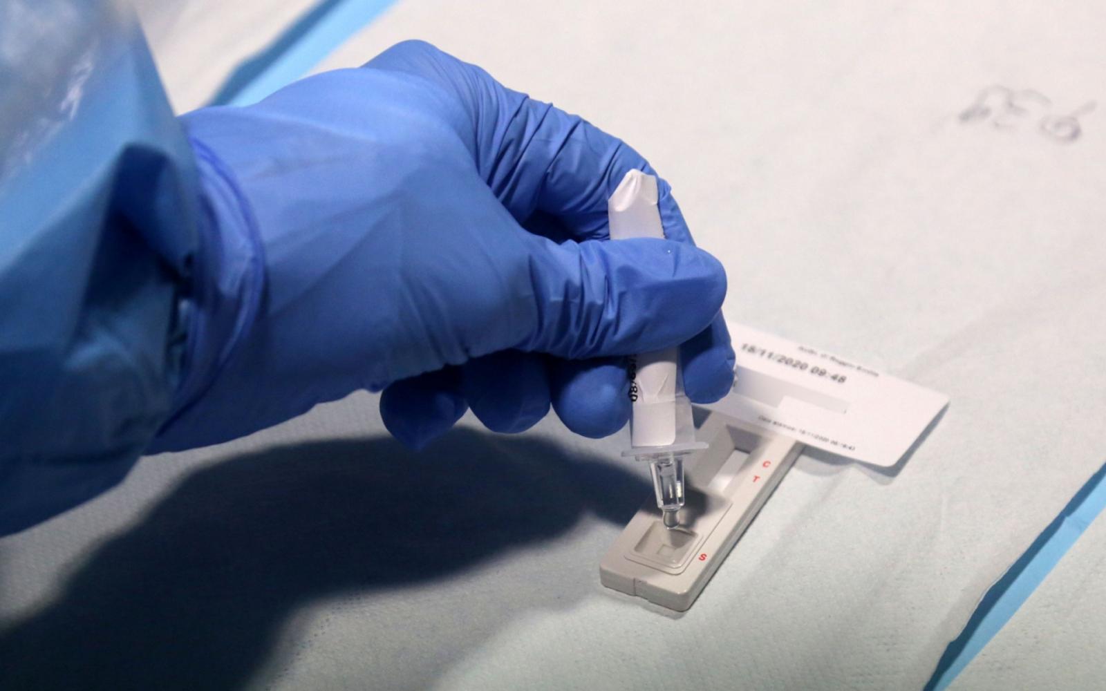 Salgono a 15 i ricoveri per Covid a Chioggia