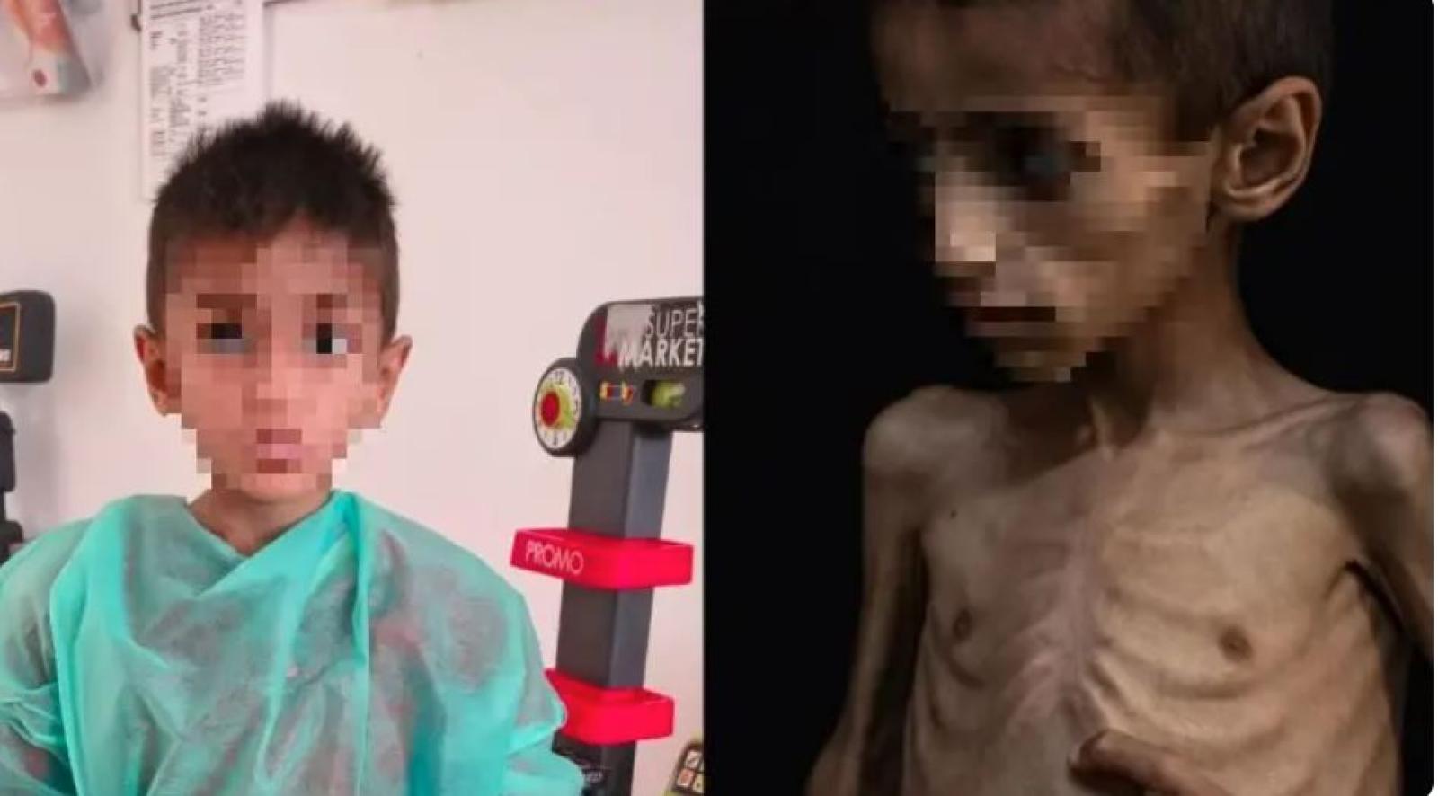 un bambino simbolo di speranza: la storia di osama da gaza a verona