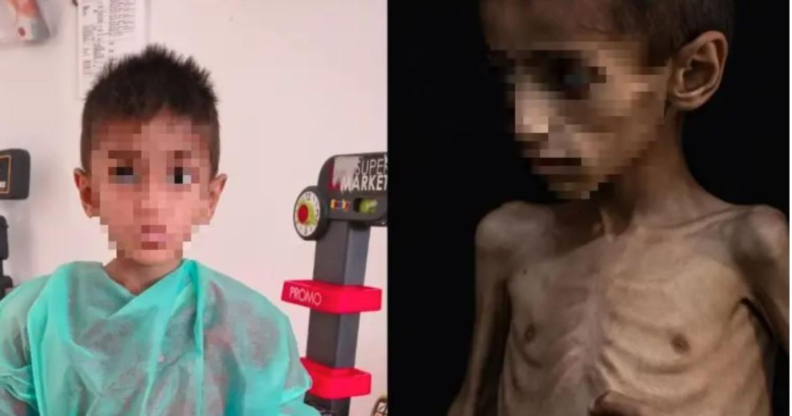 un bambino simbolo di speranza: la storia di osama da gaza a verona