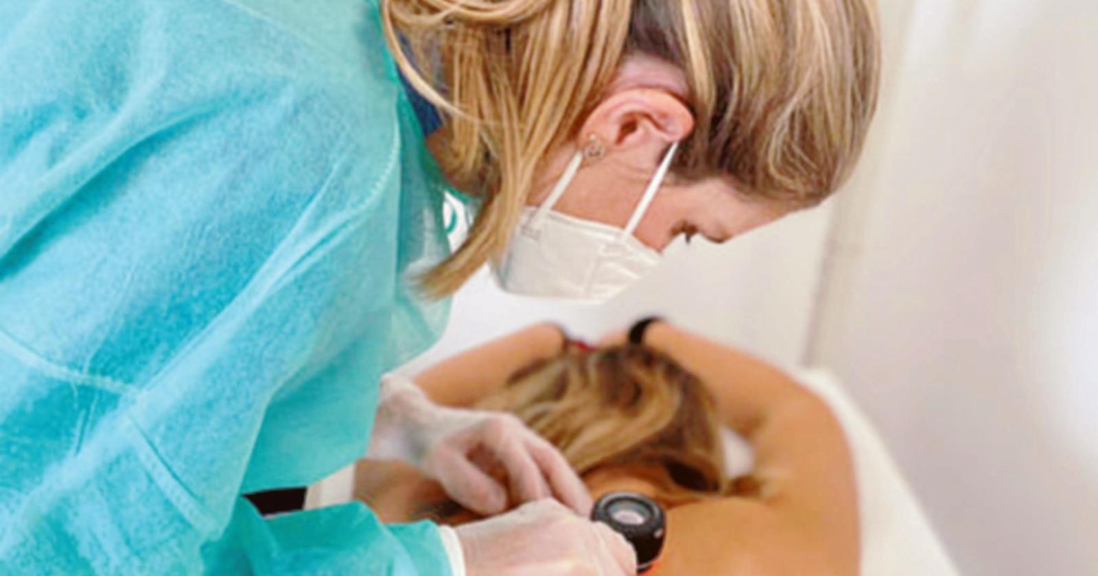 Controlli dei nei: torna la prevenzione 