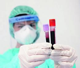 Covid, riesplodono i contagi
